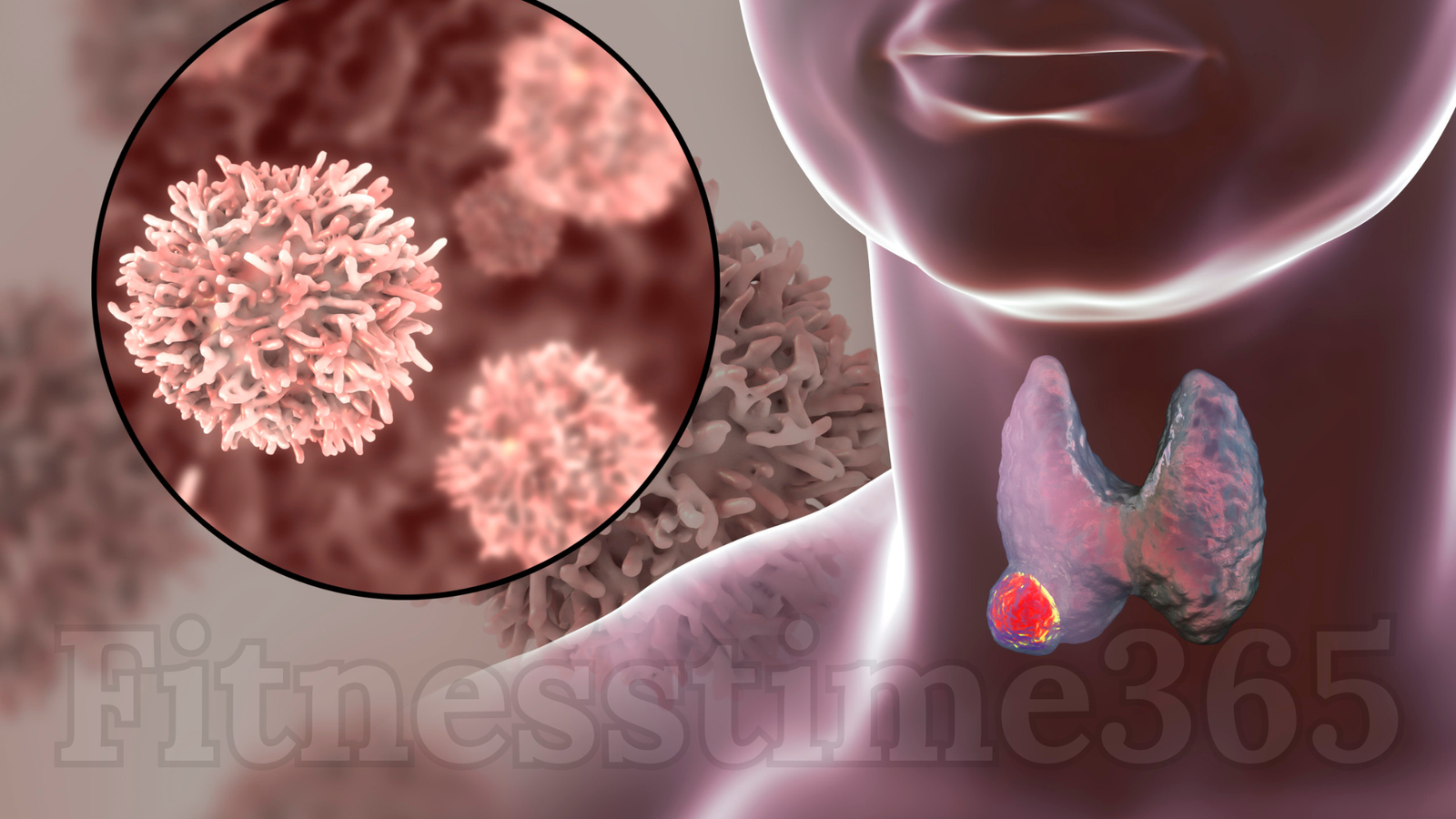 Thyroid