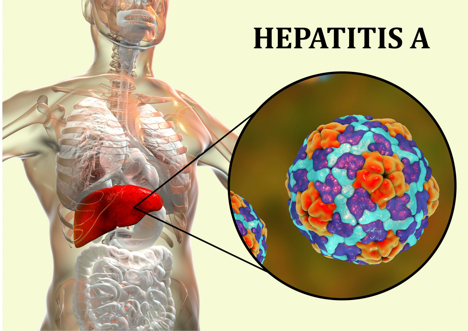 Hepatitis